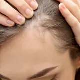 Dłonie kobiety delikatnie rozsuwają pasma włosów, ukazując cienkie, jasne włoski przy linii czoła, przypominające baby hair.