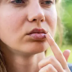 Kobieta aplikuje maść na **prosaki na ustach**. Widać zaczerwienienie i pęcherzyk.