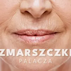 Widoczne zmarszczki palacza wokół ust starszej osoby. Tekst na zdjęciu: "ZMARSZCZKI PALACZA".