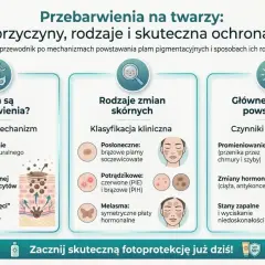 Przewodnik po przebarwieniach na twarzy: przyczyny, rodzaje i ochrona. Dowiedz się, jak powstają plamy starcze i jak im zapobiegać.