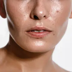 Błyszcząca skóra z widocznym **sebum** i piegami, usta lekko rozchylone.