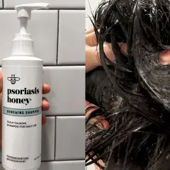 Szampon Psoriasis Honey Renewing Shampoo, idealny do codziennego stosowania, łagodzi skórę głowy. Idealny dla osób z problemami skórnymi, jak łuszczyca.