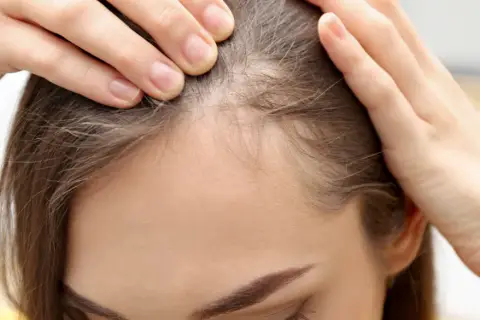 Dłonie kobiety delikatnie rozsuwają pasma włosów, ukazując cienkie, jasne włoski przy linii czoła, przypominające baby hair.