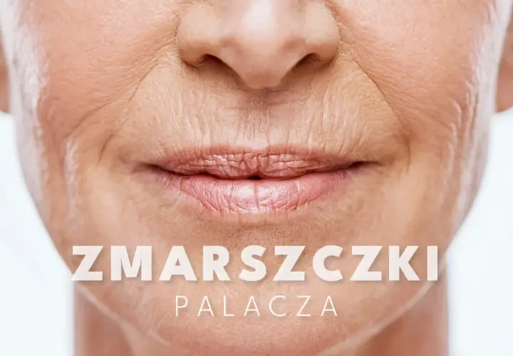 Widoczne zmarszczki palacza wokół ust starszej osoby. Tekst na zdjęciu: "ZMARSZCZKI PALACZA".