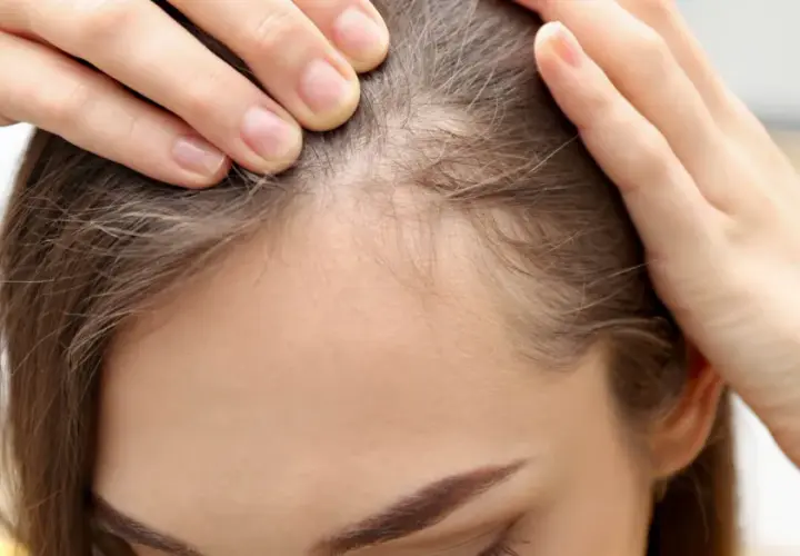 Dłonie kobiety delikatnie rozsuwają pasma włosów, ukazując cienkie, jasne włoski przy linii czoła, przypominające baby hair.