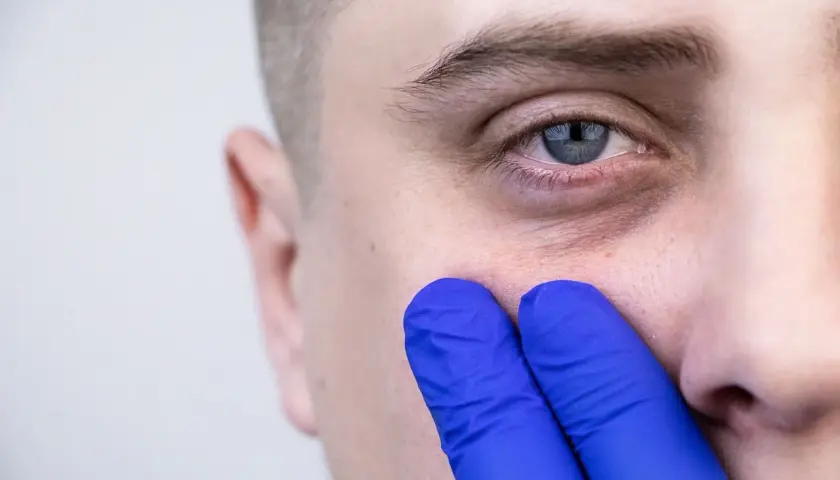 Dłoń w niebieskiej rękawiczce delikatnie dotyka skóry pod okiem, sugerując poszukiwanie rozwiązań, jak pozbyć się worków pod oczami.