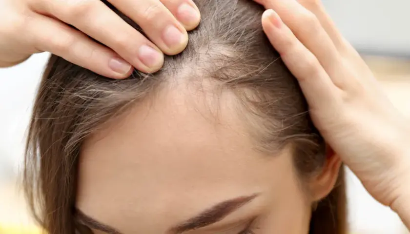 Dłonie kobiety delikatnie rozsuwają pasma włosów, ukazując cienkie, jasne włoski przy linii czoła, przypominające baby hair.