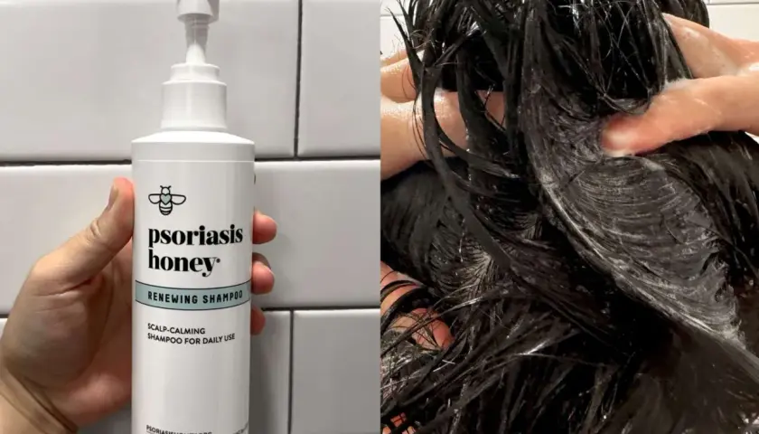 Szampon Psoriasis Honey Renewing Shampoo, idealny do codziennego stosowania, łagodzi skórę głowy. Idealny dla osób z problemami skórnymi, jak łuszczyca.
