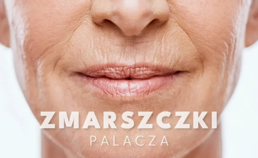 Zmarszczki palacza - Jak skutecznie wygładzić linie nad ustami?