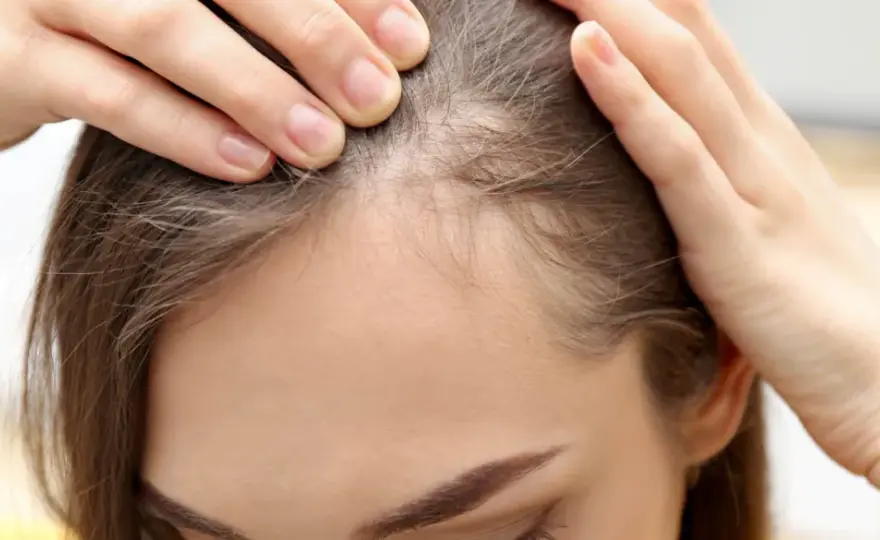 Baby hair przy czole - jak je ujarzmić bez łamania włosów?