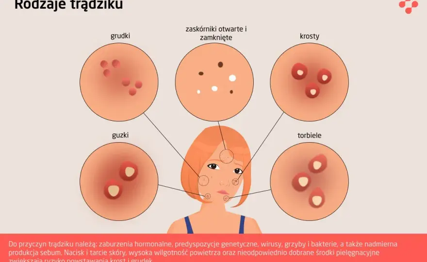 Grudki na twarzy - Jak rozpoznać ich rodzaj i wygładzić cerę?