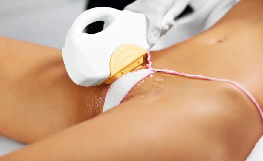 Depilacja laserowa bikini - ile kosztuje? Płytkie, głębokie, brazylijskie