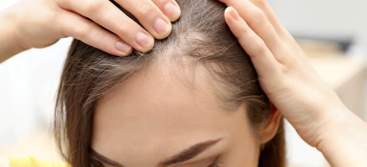 Dłonie kobiety delikatnie rozsuwają pasma włosów, ukazując cienkie, jasne włoski przy linii czoła, przypominające baby hair.