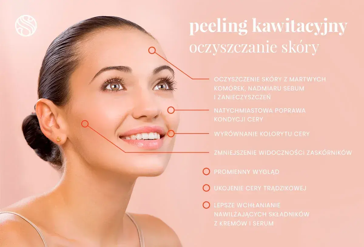 Uśmiechnięta kobieta z promienną cerą, idealna po zabiegi na twarz, jakim jest peeling kawitacyjny.