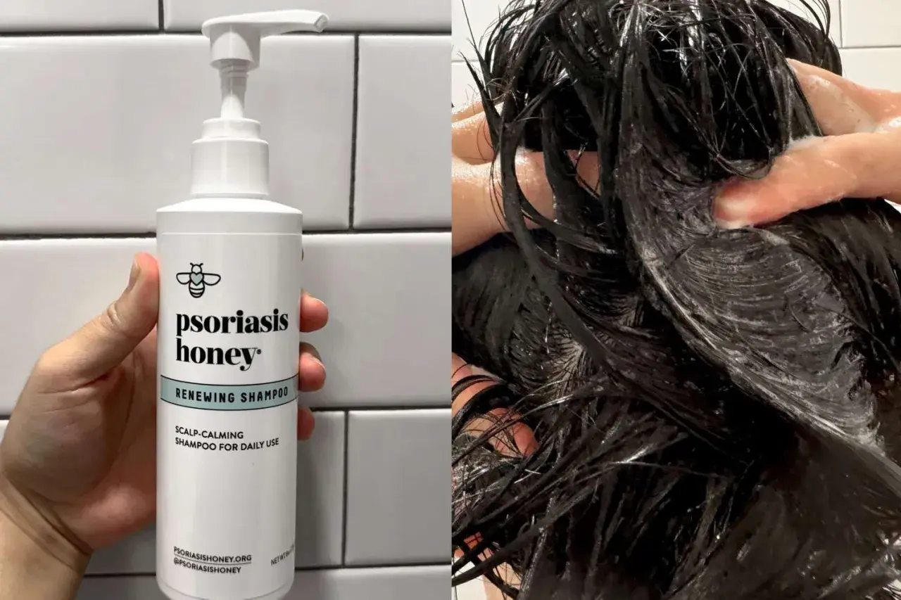 Szampon Psoriasis Honey Renewing Shampoo, idealny do codziennego stosowania, łagodzi skórę głowy. Idealny dla osób z problemami skórnymi, jak łuszczyca.